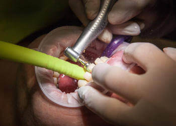 Chirurgia Orale 